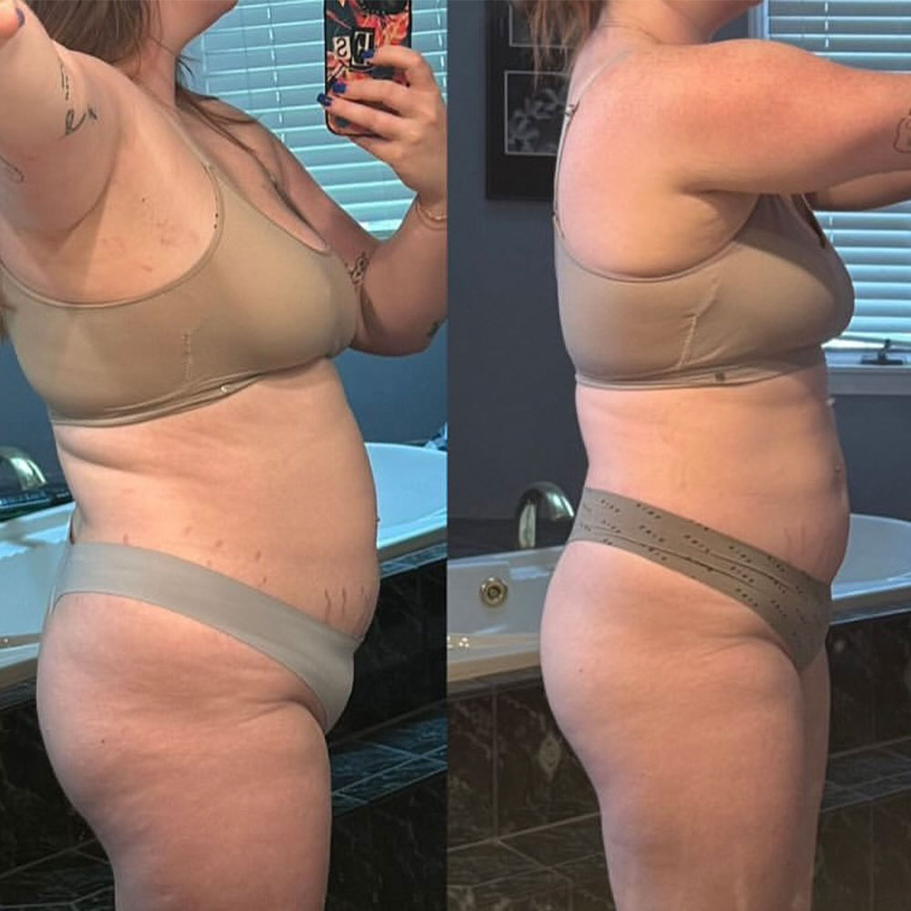 Transformation 3
