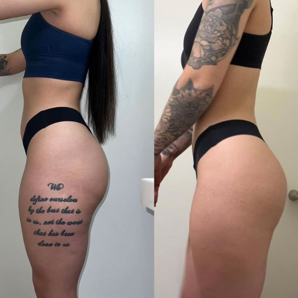 Transformation 4